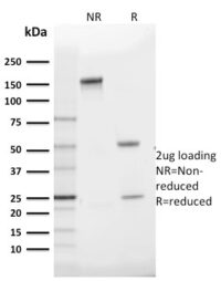 Data from SDS-PAGE analysis of Anti-GLUT1 antibody (Clone GLUT1/2475). Reducing lane (R) shows heavy and light chain fragments. NR lane shows intact antibody with expected MW of approximately 150 kDa. The data are consistent with a high purity, intact mAb.